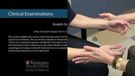 scratch test carpal tunnel|scratch collapse test peroneal nerve.